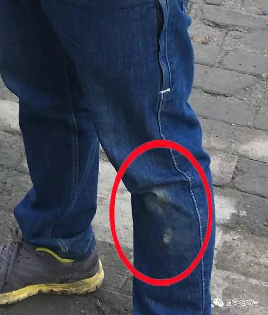 ▲ 被打的新京报记者，左腿裤子有明显破损。