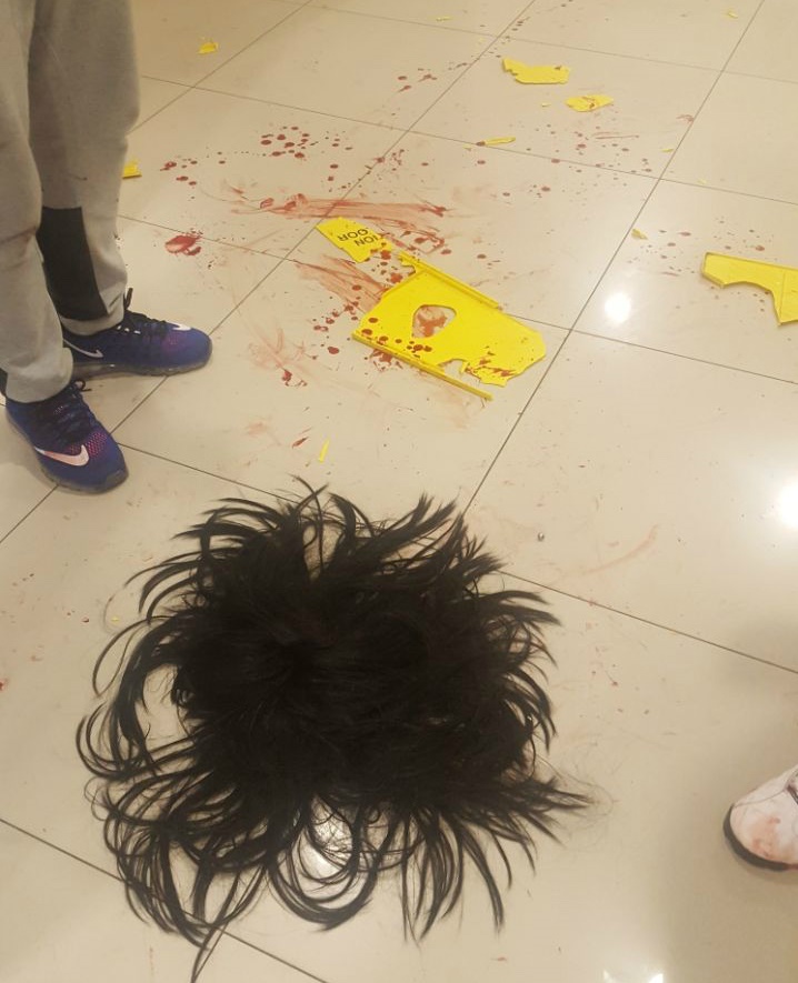 A wig lies on the hospital floor after the alleged fight. (Supplied)